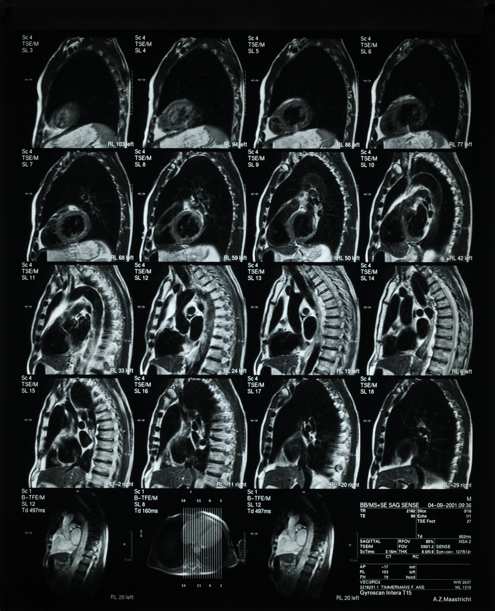 Thorax Sagittal AnatomyTOOL